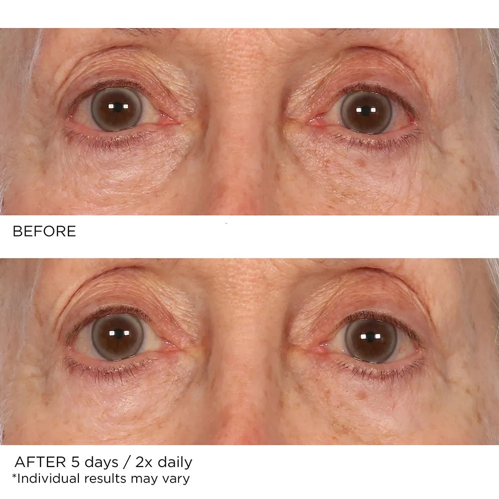 Age Defying Eye Renewal Serum