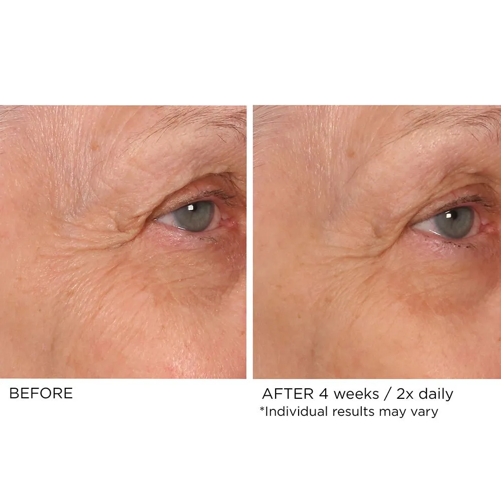 Age Defying Eye Renewal Serum