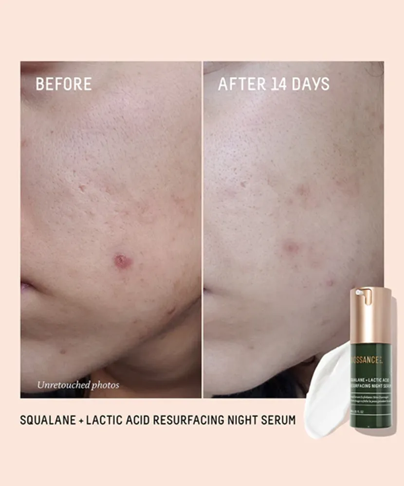 Biossance Squalane   10% Lactic Acid Resurfacing Serum