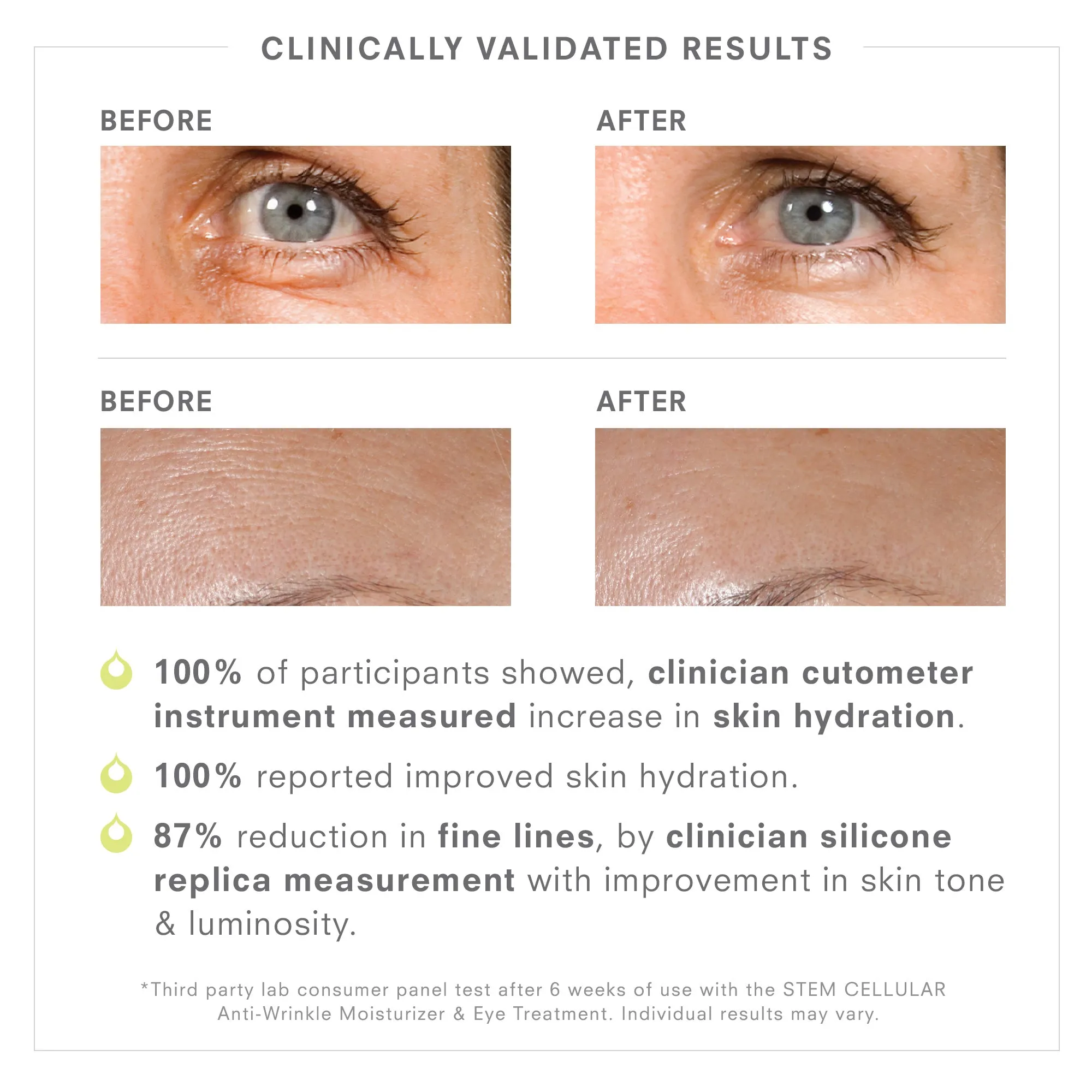 Stem Cellular Anti-Wrinkle Eye Treatment