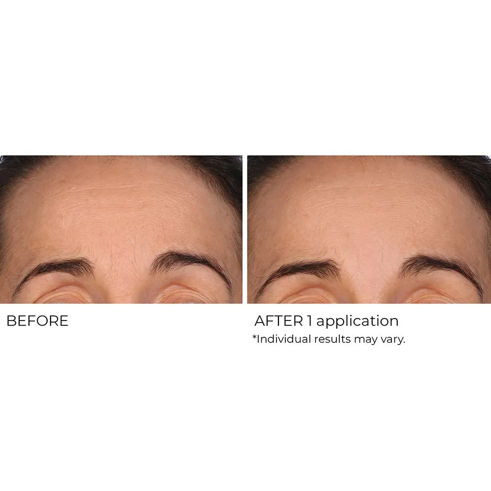 Wrinkle Blur Targeted Treatment